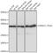 Voltage Dependent Anion Channel 1 antibody, GTX32961, GeneTex, Western Blot image 