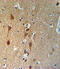 SMAD Family Member 3 antibody, A00059, Boster Biological Technology, Immunohistochemistry paraffin image 