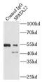 Spermatogenesis Associated 22 antibody, FNab08162, FineTest, Immunoprecipitation image 
