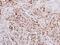 Ribosomal Protein S6 Kinase B2 antibody, GTX101886, GeneTex, Immunohistochemistry paraffin image 