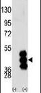 Phosphorylase Kinase Catalytic Subunit Gamma 2 antibody, PA5-14064, Invitrogen Antibodies, Western Blot image 