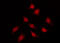 Heat Shock Protein Family B (Small) Member 1 antibody, GTX17677, GeneTex, Immunofluorescence image 