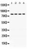 Integrin Subunit Beta 3 antibody, PB9806, Boster Biological Technology, Western Blot image 