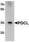 Phosducin Like antibody, A03099, Boster Biological Technology, Western Blot image 