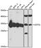 Glutathione S-Transferase Omega 1 antibody, A15354, ABclonal Technology, Western Blot image 