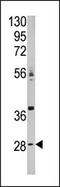 Carbonic Anhydrase 9 antibody, AP13030PU-N, Origene, Western Blot image 
