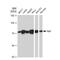 Raf-1 Proto-Oncogene, Serine/Threonine Kinase antibody, GTX01196, GeneTex, Western Blot image 