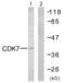 Cyclin Dependent Kinase 7 antibody, abx013216, Abbexa, Western Blot image 