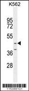 Otoconin 90 antibody, 55-980, ProSci, Western Blot image 