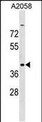 Adenosine Deaminase TRNA Specific 3 antibody, PA5-48852, Invitrogen Antibodies, Western Blot image 