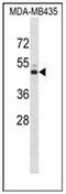 Potassium Voltage-Gated Channel Subfamily J Member 13 antibody, AP52310PU-N, Origene, Western Blot image 