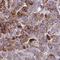 PEAK Family Member 3 antibody, HPA057806, Atlas Antibodies, Immunohistochemistry paraffin image 