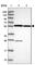 Zinc Finger Protein 285 antibody, HPA046100, Atlas Antibodies, Western Blot image 