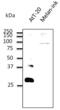 RAB27B, Member RAS Oncogene Family antibody, LS-B12412, Lifespan Biosciences, Western Blot image 