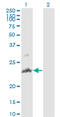 TNF Superfamily Member 14 antibody, LS-C133566, Lifespan Biosciences, Western Blot image 