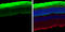 Rhodopsin antibody, GTX134136, GeneTex, Immunohistochemistry paraffin image 