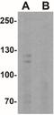 Calcium Sensing Receptor antibody, NBP2-41271, Novus Biologicals, Western Blot image 