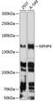 Nephrocystin 4 antibody, 23-761, ProSci, Western Blot image 
