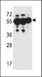 Sosondowah Ankyrin Repeat Domain Family Member C antibody, LS-C156354, Lifespan Biosciences, Western Blot image 