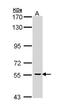 Cell Division Cycle 73 antibody, GTX110280, GeneTex, Western Blot image 