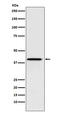 Poly(RC) Binding Protein 1 antibody, M02636-1, Boster Biological Technology, Western Blot image 