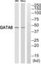 GATA Binding Protein 6 antibody, abx015117, Abbexa, Western Blot image 
