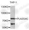 Cytosolic phospholipase A2 gamma antibody, A7753, ABclonal Technology, Western Blot image 