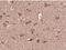 Parkin RBR E3 Ubiquitin Protein Ligase antibody, orb312554, Biorbyt, Immunohistochemistry paraffin image 