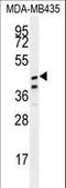 Sterile Alpha Motif Domain Containing 7 antibody, LS-C162858, Lifespan Biosciences, Western Blot image 