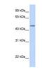 Transducin beta-like protein 2 antibody, NBP1-62346, Novus Biologicals, Western Blot image 