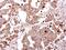 Galactosidase Beta 1 antibody, NBP1-32018, Novus Biologicals, Immunohistochemistry paraffin image 