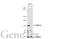 DNA Methyltransferase 3 Alpha antibody, GTX129126, GeneTex, Western Blot image 