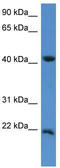 Inner Mitochondrial Membrane Peptidase Subunit 2 antibody, TA342986, Origene, Western Blot image 