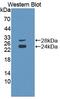 CD8 antibody, MBS2004595, MyBioSource, Western Blot image 