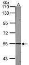 LCK Proto-Oncogene, Src Family Tyrosine Kinase antibody, PA5-34653, Invitrogen Antibodies, Western Blot image 