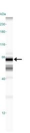 Translocase Of Outer Mitochondrial Membrane 70 antibody, NB110-58347, Novus Biologicals, Western Blot image 