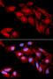 Catenin Delta 1 antibody, LS-C331607, Lifespan Biosciences, Immunofluorescence image 