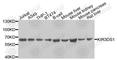 Killer cell immunoglobulin-like receptor 3DS1 antibody, A9936, ABclonal Technology, Western Blot image 