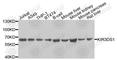 Killer Cell Immunoglobulin Like Receptor, Three Ig Domains And Short Cytoplasmic Tail 1 antibody, A9936, ABclonal Technology, Western Blot image 