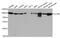 Chloride Voltage-Gated Channel 5 antibody, MBS2517253, MyBioSource, Western Blot image 