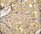 Transient Receptor Potential Cation Channel Subfamily M Member 8 antibody, PA5-15508, Invitrogen Antibodies, Immunohistochemistry frozen image 