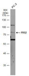 Fibroblast Growth Factor Receptor Substrate 2 antibody, GTX103288, GeneTex, Western Blot image 