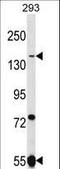 UHRF1 Binding Protein 1 Like antibody, LS-C160424, Lifespan Biosciences, Western Blot image 