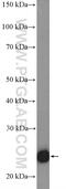Twist Family BHLH Transcription Factor 1 antibody, 25465-1-AP, Proteintech Group, Western Blot image 