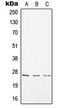 CD8 antibody, LS-C351975, Lifespan Biosciences, Western Blot image 