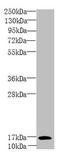 Proliferation And Apoptosis Adaptor Protein 15 antibody, LS-C676241, Lifespan Biosciences, Western Blot image 