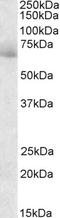 A-Kinase Anchoring Protein 10 antibody, LS-C54470, Lifespan Biosciences, Western Blot image 