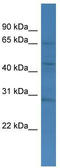 Transmembrane And Coiled-Coil Domains 4 antibody, TA333410, Origene, Western Blot image 