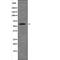 Dual Specificity Tyrosine Phosphorylation Regulated Kinase 2 antibody, PA5-64575, Invitrogen Antibodies, Western Blot image 