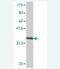 Transmembrane Serine Protease 3 antibody, H00064699-M01, Novus Biologicals, Western Blot image 